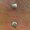 two dermal anchors on the nape of the neck.  Top dermal anchor is healed, bottom dermal anchor is fresh.  One more to come.