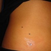 Fresh dermal anchor with cz on the hip.  Two more to come