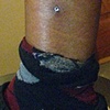 SUPER HEALED six+ month old dermal anchor on the outer calf.
