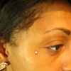 Fresh 18g dermal anchor 