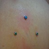 Two healed dermal anchors(left and right), and two fresh dermal anchors(up and down) on the right shoulder blade 