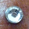 Super healed dermal anchor, freshly changed to bezel set cz. It is now a bit swollen from changing it, not uncommon. (zoomed in view)