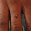 fresh dermal anchor on the finger