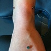 Three dermal anchors.  Underneath the wrist is fresh.  On top of the wrist is a week old.  Hand is over 3 months old.