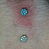 Two healed surface anchors on the neck.  Top one freshly changed the gem to the flower cz