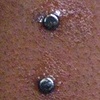 Two fresh dermal anchors on the wrist(zoomed in view)