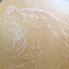 Healed Scars