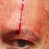 Luis's facial scar