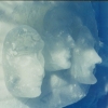 Ice and Snow