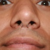 Septum
