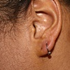 Lobe