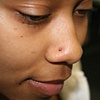 Nostril
