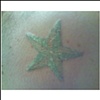 Steve's Star Lasering