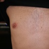 Nipples