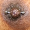 Nipple