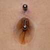 Reconstructed Navel