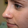 Nostril