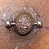 Nipple