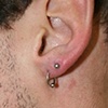 Lower Lobe