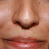 Septum