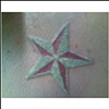 Steve's Laser Removal