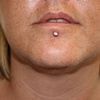 Labret