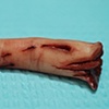 Severed Finger