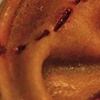 Bitten Ear