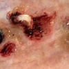 More Maggots