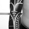 eric's arm