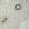 Umbilical 2