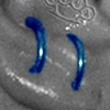 Double Orbital (Lobe to Conch)