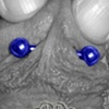 Frenum Piercing