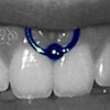 Smiley