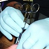 Nape Process