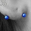 Transversal Lobe 