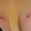 Side Breast