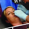 Cheek Bone Process