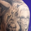 MP Back of Upper Arm