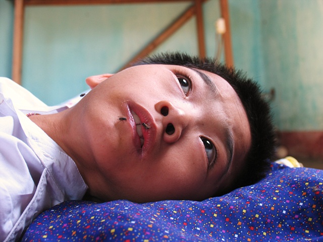 This boy is paralyzed due to his father's exposure to Dioxin during Vietnams war with Cambodia, remnants from before 1975.