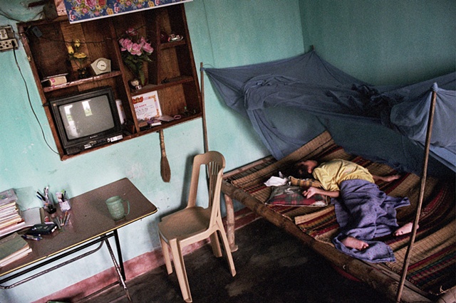 A young child afflicted with Spina Bifida rests at home, Danang