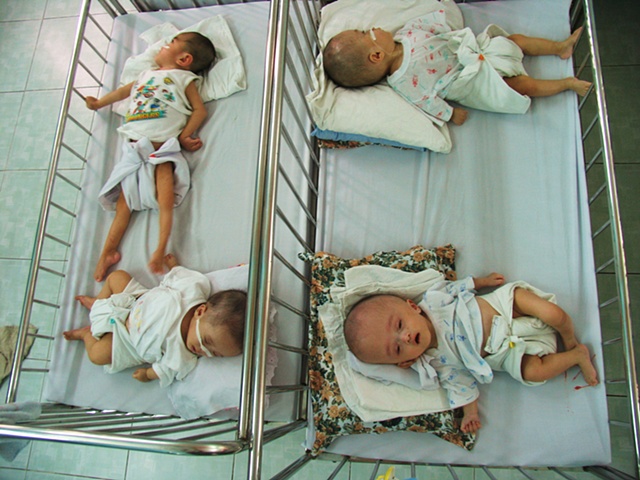 Four babies, one clearly affected by Dioxin, sleep at Go Vap orphanage.