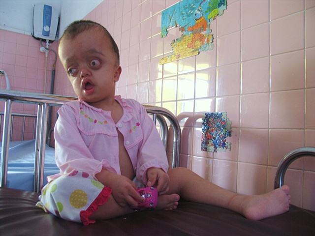 Dioxin has shaped this young girl's body into something I cannot fully understand.