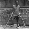 The Amputees of Sierra Leone