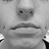 Cheeks