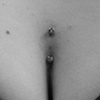 Surface- Sternum