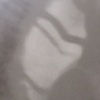 Eye Piece 2