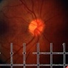 Retina