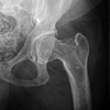 2009 was the year my hip hurt so bad that I had to be put on pain pills.