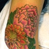 Mikey's knee